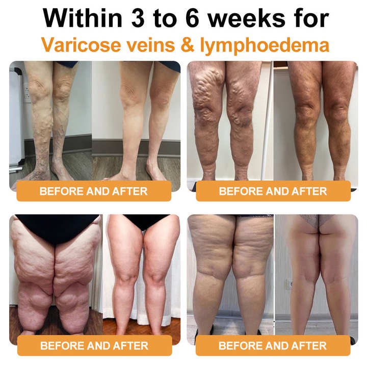 Futusly™ Ultrasoon & Ver-infrarood Detox Armband – Vetverbranding & Bloedsuikerbalans