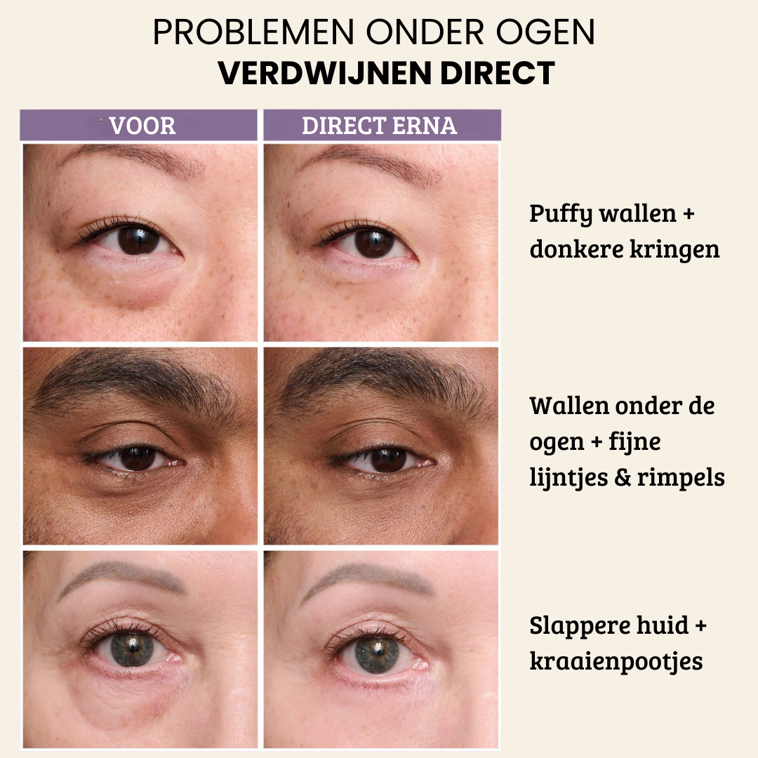 Valcetti - FirmX Easy-Wear Anti-Wrinkle Eye Cream