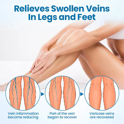 Timilk® VeinGuard Kruidenspray