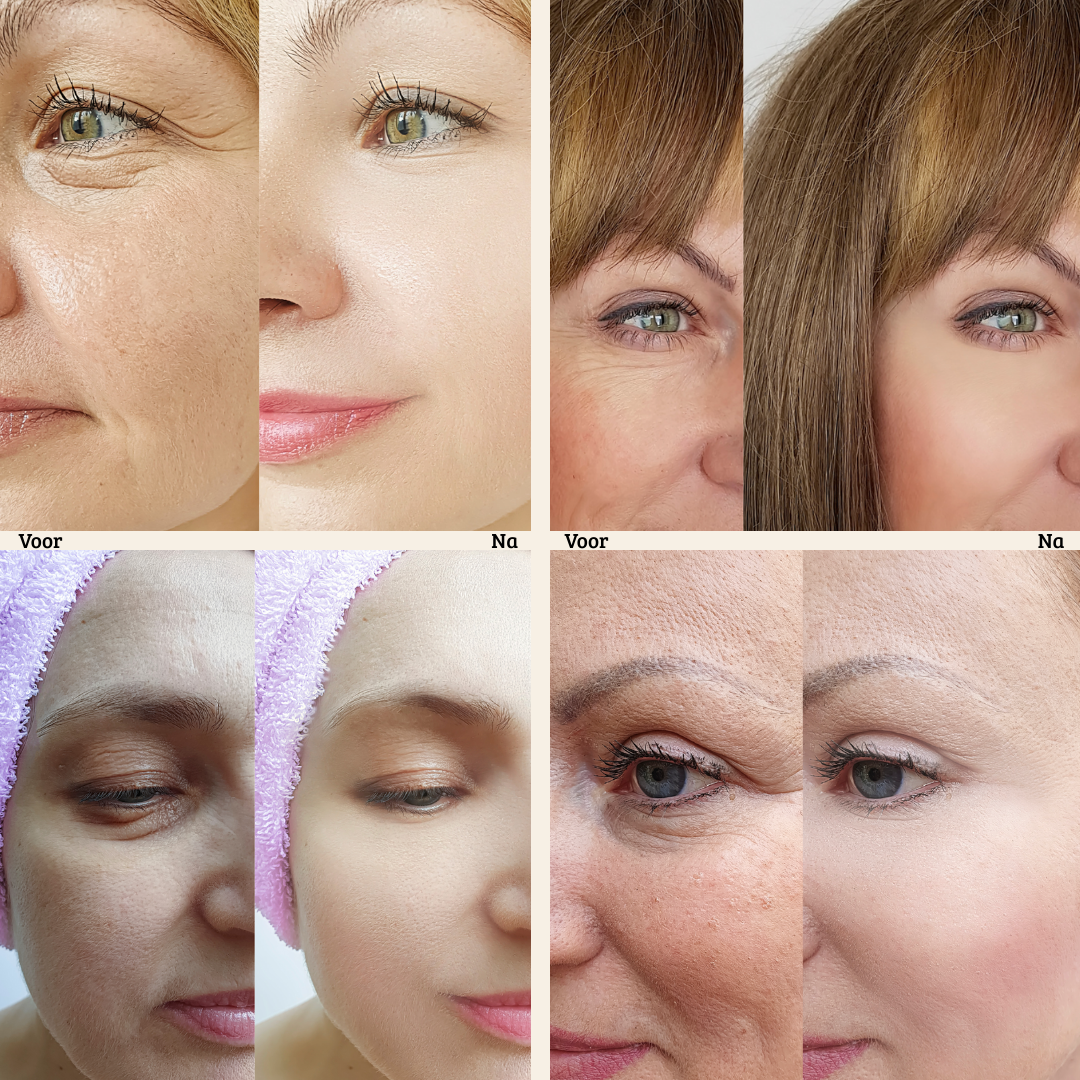 Valcetti - FirmX Easy-Wear Anti-Wrinkle Eye Cream