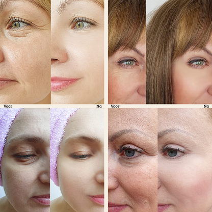 Valcetti - FirmX Easy-Wear Anti-Wrinkle Eye Cream